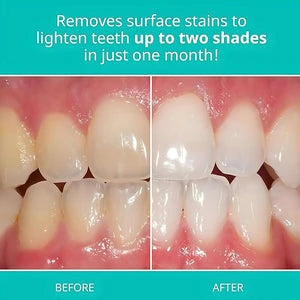 Opalescence - Whitening Toothpaste | أوباليسنس - معجون أسنان لتبييض الأسنان