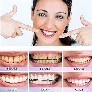 Nicotinamide Dazzle White Toothpaste | معجون أسنان نيكوتيناميد دازل